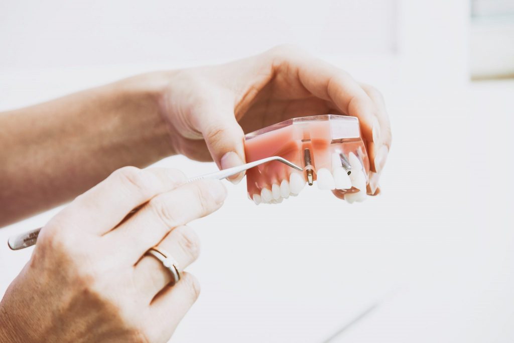 How often should you need to go to the dentist?